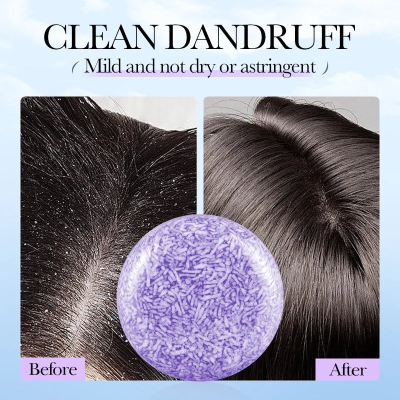 Lavender Shampoo Soap 1Box AntiDandruff & Anti-Itching Deep Cleansing Hair Care Strengthening Hair Roots Lightening & Revitalizi
